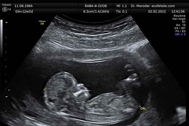 the unborn inside a womb