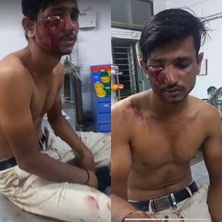 Pictures of Purushottam after the attack.