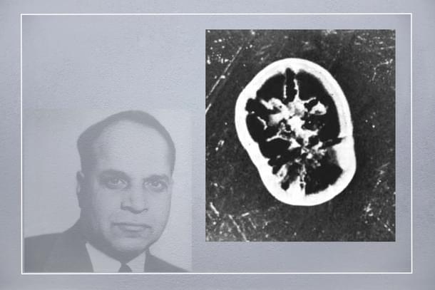 The mould of Sterptomyces aureofaciens that yielded A-377 (later Aureomycin antibiotic). From 'Scientific American', April, 1949