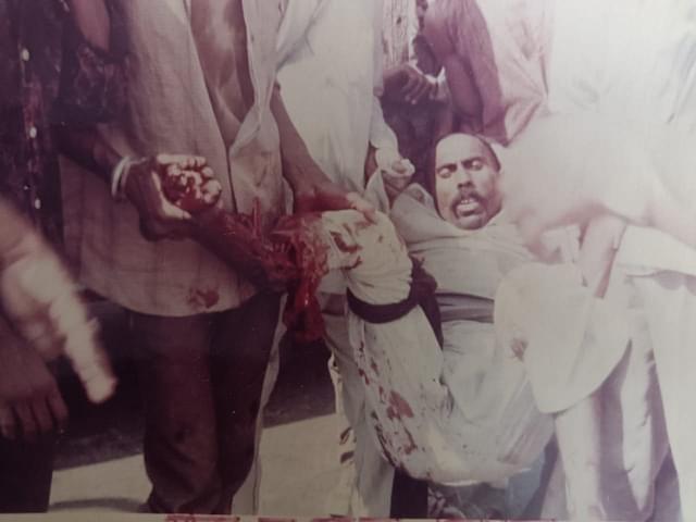 Picture of a badly injured karsevak clicked by Tripathi in 1990.