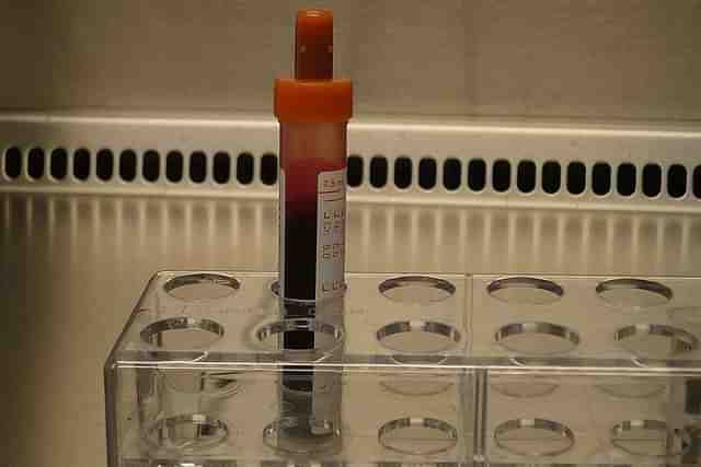 Blood sample (representative image)