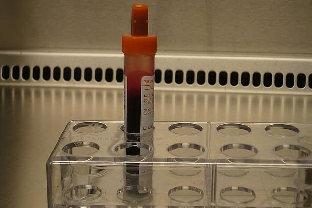 Blood sample (representative image)