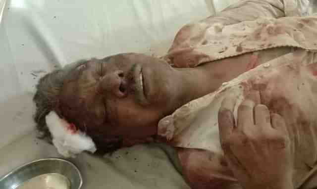 Victim Nazir Masih, who is believed to be hospitalised 