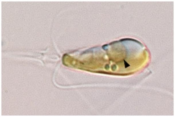 A nitroplast inside B. bigelowii, marked by a black arrow. File image (Wikimedia Commons)